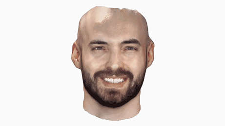 Digital orthodontic records used during treatment planning